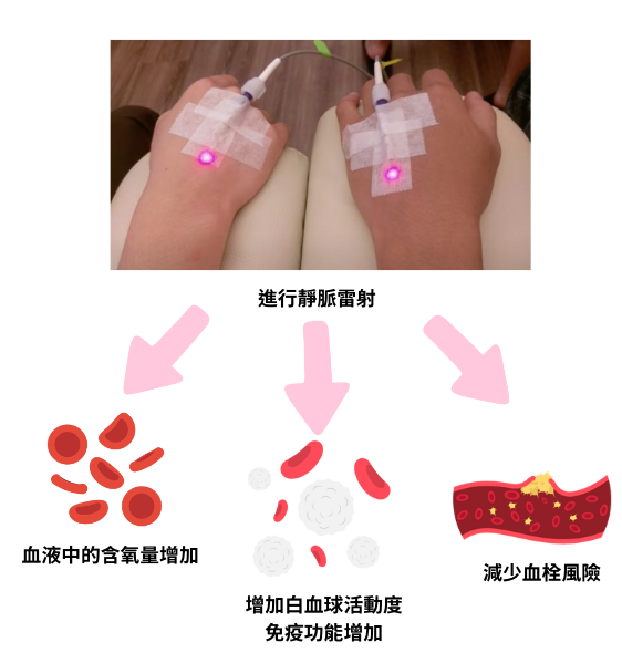 靜脈雷射與運動禁藥規範說明