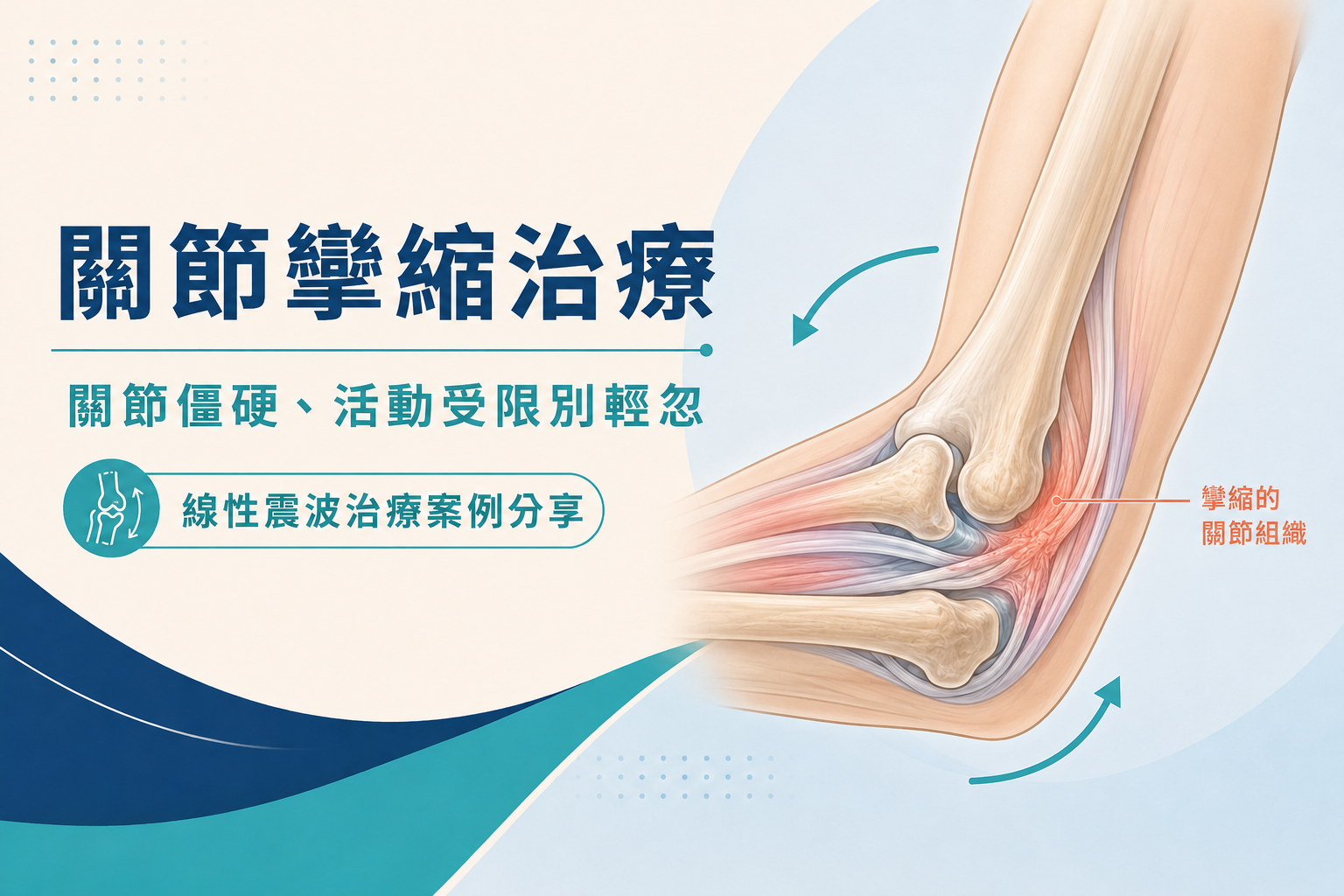 關節攣縮治療